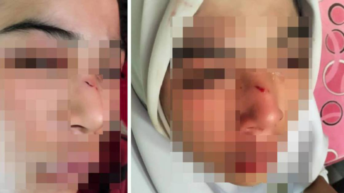 Kelantan Education Department Investigates Alleged Assault on 15-Year-Old Student
