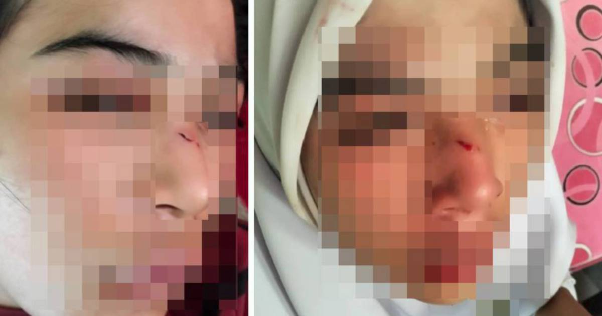 Kelantan Education Department Investigates Alleged Assault on 15-Year-Old Student