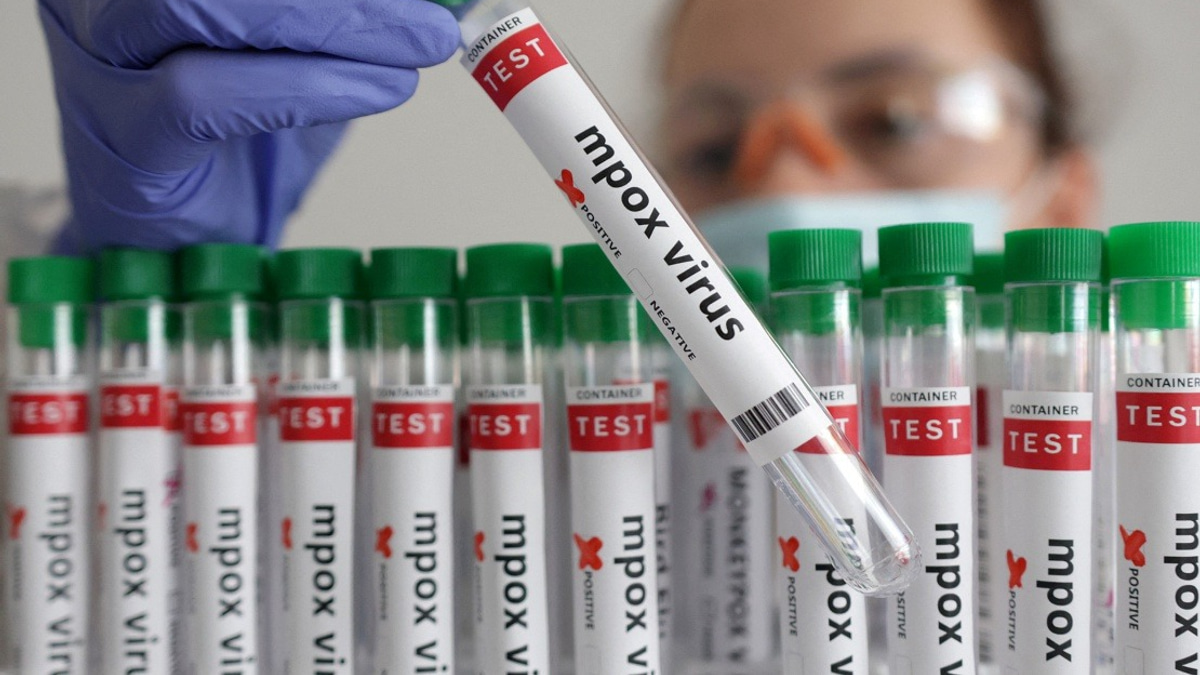 Guinea-Bissau Reports First Mpox Case as Health Authorities Launch Containment Drive