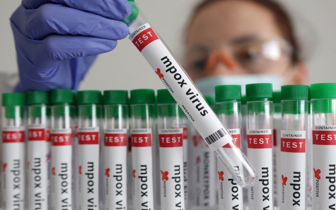Guinea-Bissau Reports First Mpox Case as Health Authorities Launch Containment Drive
