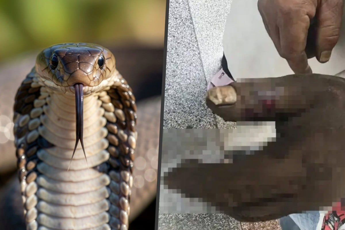 Cobra Bite Rescue Attempt Backfires: Wife Poisons Herself While Saving Husband in Yunnan
