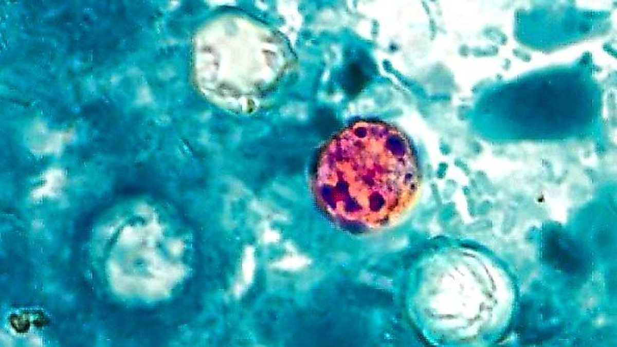 The Invisible Enemy: Why Cyclospora Outbreaks Are So Hard to Track Down