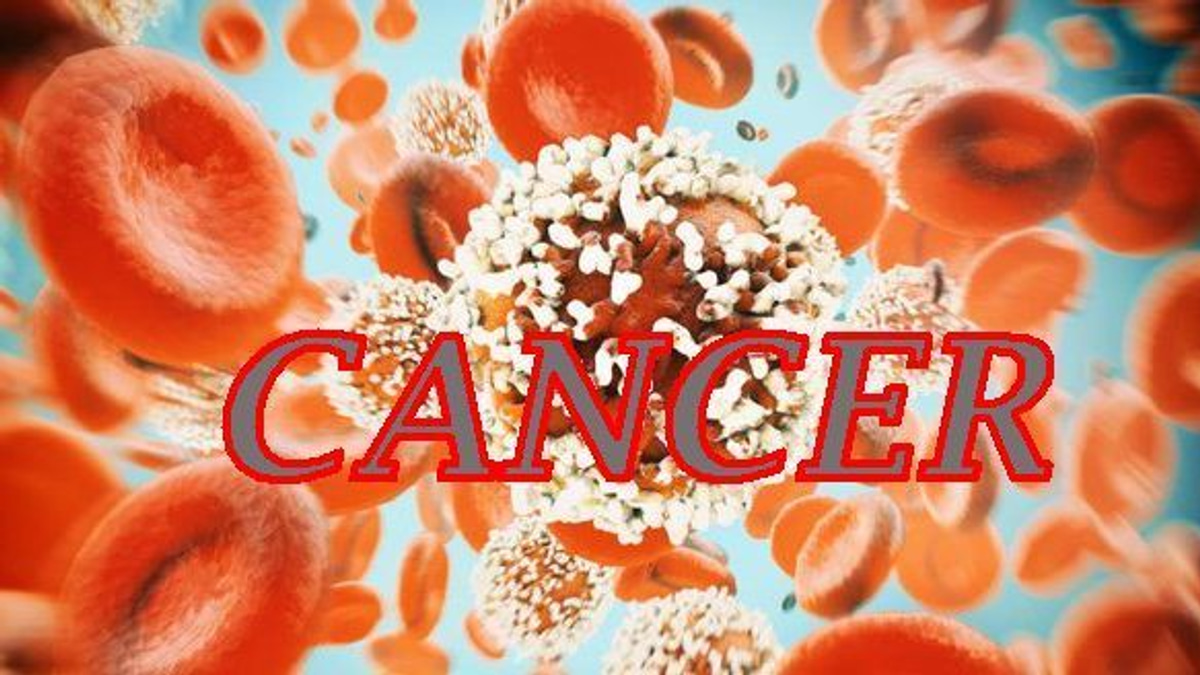 The Rising Threat of Colorectal Cancer in Young Malaysians
