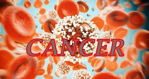 The Rising Threat of Colorectal Cancer in Young Malaysians