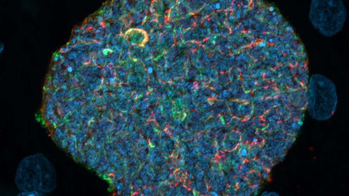 Australian Scientists Turn Mosquito Bites Into Malaria Immunity Boosters