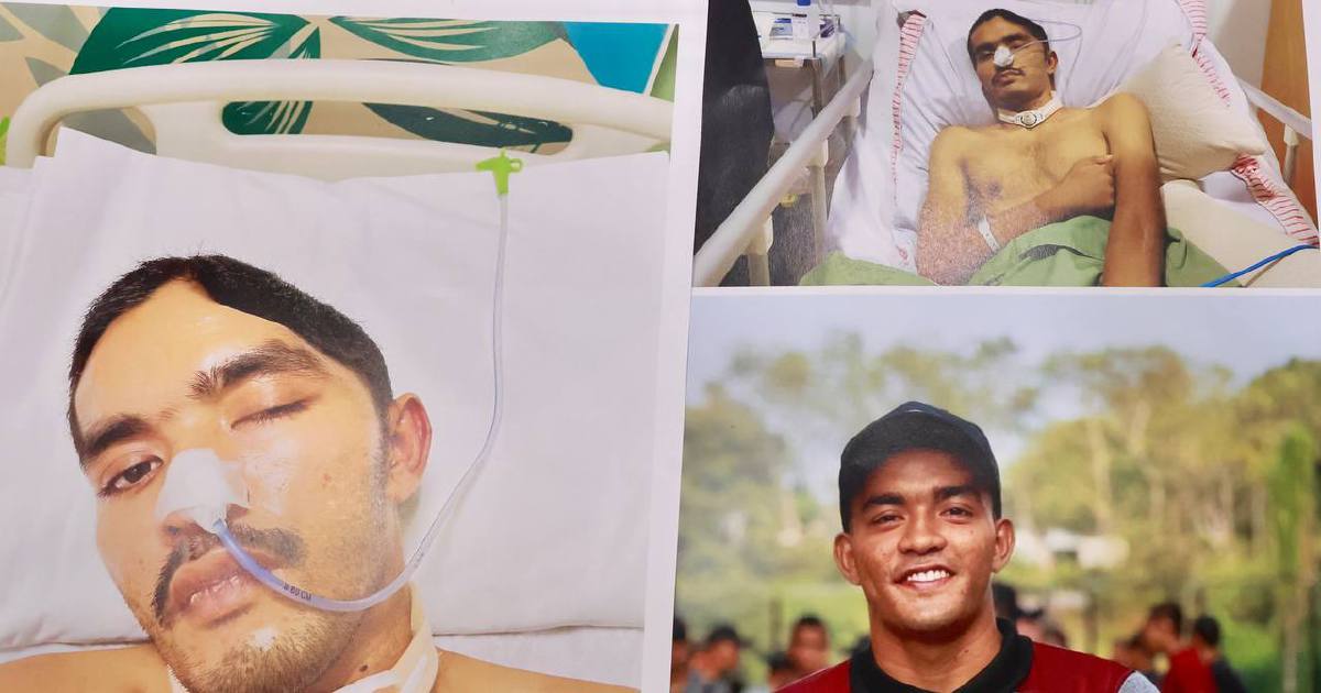 Army Concludes Investigation Into Johor Commando Injury; Disciplinary Action Begins